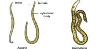 Describe on Phylum Aschelminthes