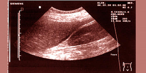 A New Progress to Ultrasound Imaging