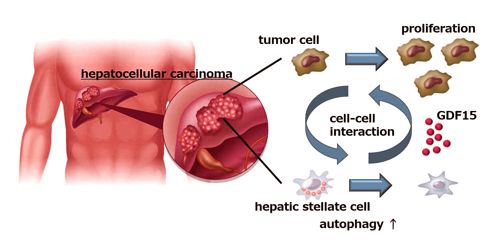 Liver cancer cells causes Stromal Cells to enhances tumor growth 1