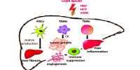 Liver cancer cells cause Stromal Cells to enhances tumor growth