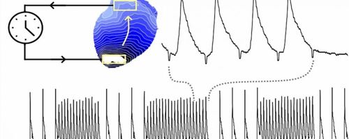 Scheming cardiovascular waves with light to identify abnormity rapid heart rhythms 1