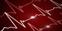 Scheming cardiovascular waves with light to identify abnormity rapid heart rhythms