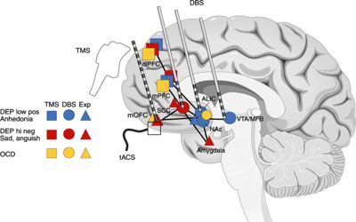 Effect-electrical-stimulation-personalized-medicine-with-deep-brain-stimulation-1