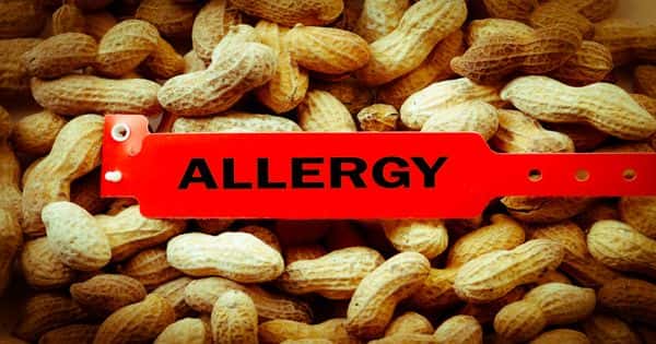 Changes to food allergy guidelines have led to a decrease in peanut allergy among infants