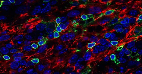 Chemical cocktail enables the production of large numbers of muscle stem cells