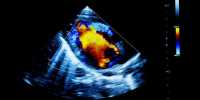 Researchers demonstrated a new technique for creating ultrasound images