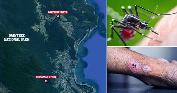 Deadly-Flesh-Eating-Bacteria-In-Australia-May-Be-Spreading-Via-Possum-Poop-Or-Mosquitos-1