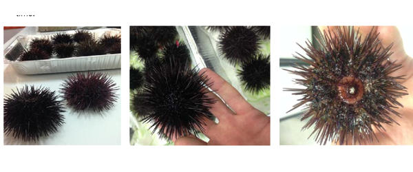 Geneticist-uncover-the-diversity-of-sea-urchin-microbiome-1