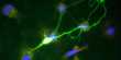Scientists explain how neural systems process and store information