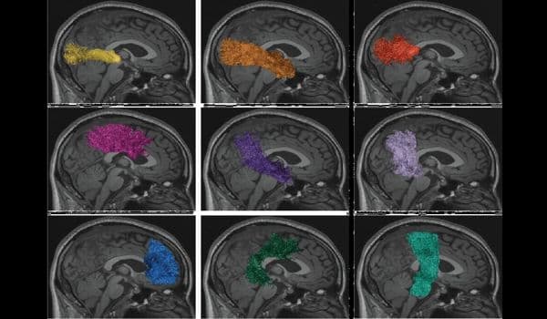 Cloud-Technologies-expands-Human-Cognition-and-Brain-Networks-1