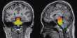 Brain MRI Image Labeling is Automated by Researchers