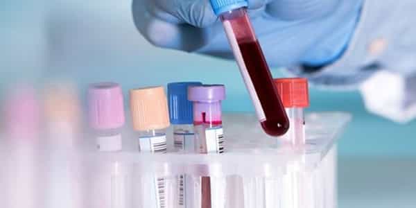 A-New-Test-for-Detecting-Depression-in-Blood-Samples-has-been-developed-1