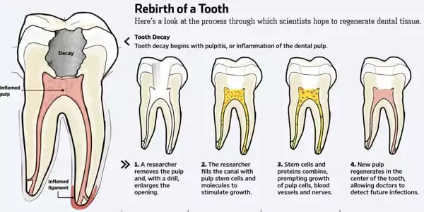 A-New-Treatment-Stimulates-the-Growth-of-New-Teeth-1