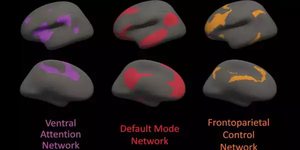 In-People-with-Alzheimers-Gene-Mutation-White-Matter-Integrity-is-Disrupted-1