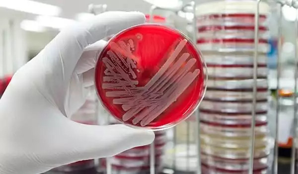 Antibiotic-Resistance-is-Determined-in-Less-Than-90-Minutes-1