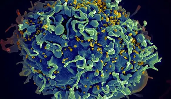 Scientists-are-Planning-a-Human-Trial-of-a-New-Vaccine-that-Kills-HIV-in-Monkeys-1
