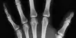 A New Target Could Help Protect Our Bones as We Get Older
