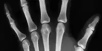 A New Target Could Help Protect Our Bones as We Get Older