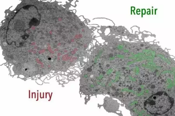 How Immune Cells are regulated during Wound Healing 1