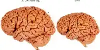 Scientists Warn that Human Brains are Shrinking