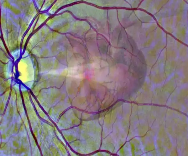 New-AI-System-can-Analyze-Eye-Scans-to-Identify-Heart-Disease-1