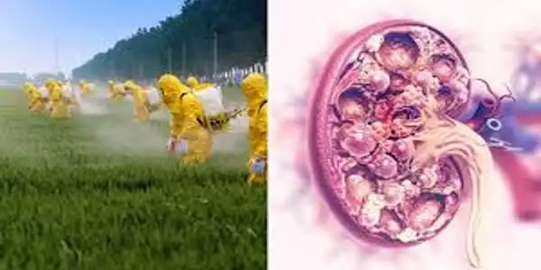 Pesticide-related-to-Chronic-Kidney-Dysfunction-1