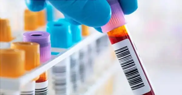 A Blood Test as a Potential Diagnostic Tool for Alzheimer’s Disease