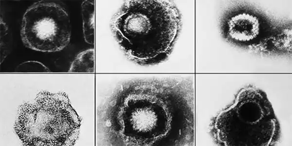 A-New-Method-of-Attacking-Herpesviruses-has-been-Discovered-1