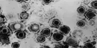 A New Method of Attacking Herpesviruses has been Discovered