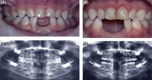 Are-Teeth-Bones-And-Where-Do-They-Come-From-Anyway-1