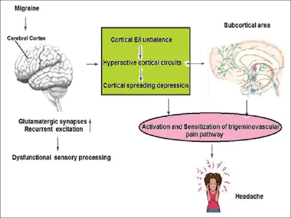 Migraines-Triggered-by-Metabolite-Level-Changes-1