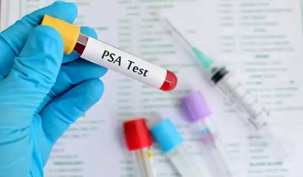 A-New-Prostate-Cancer-Test-may-help-to-Minimize-Unneeded-Biopsies-1