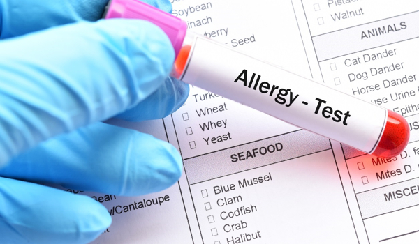 An-Unique-Allergy-Test-that-is-both-Painless-and-Reliable-1