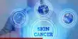 Preventing Skin Cancer with a Vaccination is a Possibility