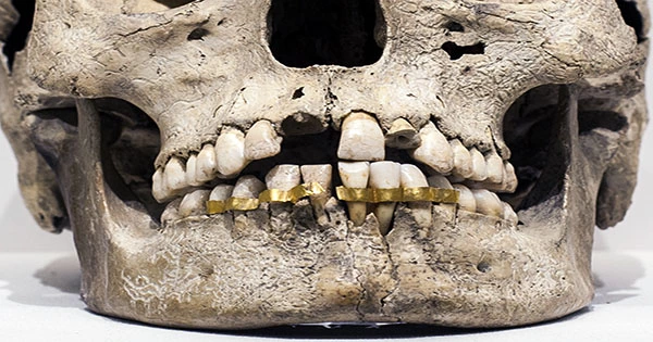Fancy Ancient Maya Tooth Jewelry May Have Helped Ward off Oral Infections Too