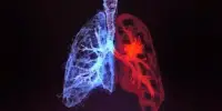 A Deep Learning Method might simplify Radiation for Lung Cancer