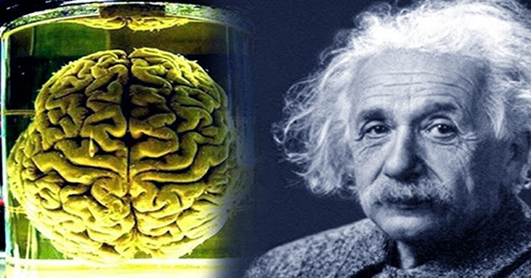 How a Jar of Kraft Miracle Whip Mayonnaise Became Home to Einstein’s Brain