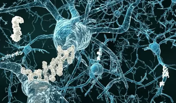 A-Model-explains-how-Errors-in-RNA-Splicing-lead-to-Alzheimers-Disease-1