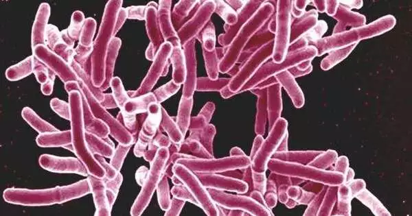 Bone-eating TB outbreak was Mysterious and Resembled an Earlier Variety