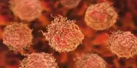 Treatment-resistant Prostate Cancer Therapies are being Developed