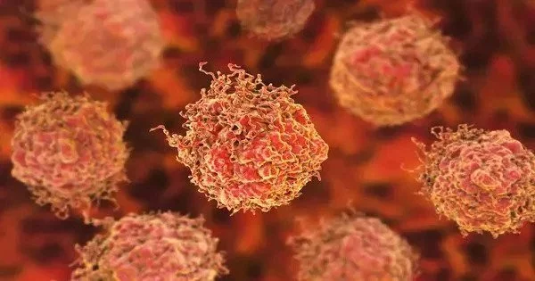Treatment-resistant Prostate Cancer Therapies are being Developed