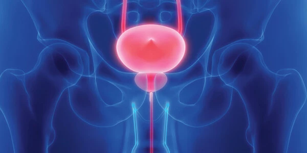 Aggressive prostate cancer linked to ancestral heritage