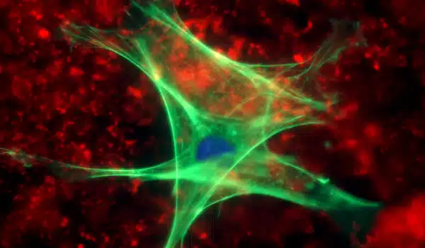 Social isolation triggers astrocyte-mediated deficits in learning and memory