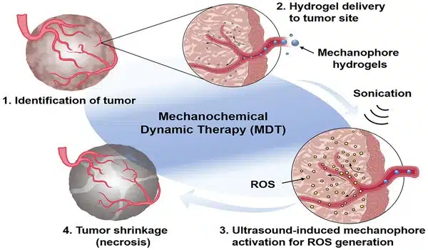 Ultrasound activates anticancer agent