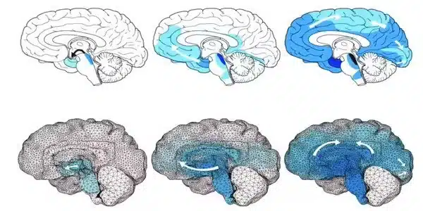 Dementia study reveals how toxic proteins spread through brain