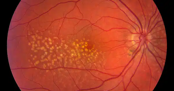 Retinal Scans are a Non-invasive, Low-cost Method of Monitoring Human Aging