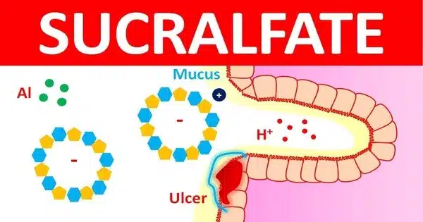 Sucralfate – a medication