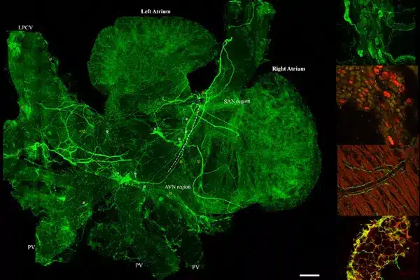 Researchers create digital map of sympathetic nervous system