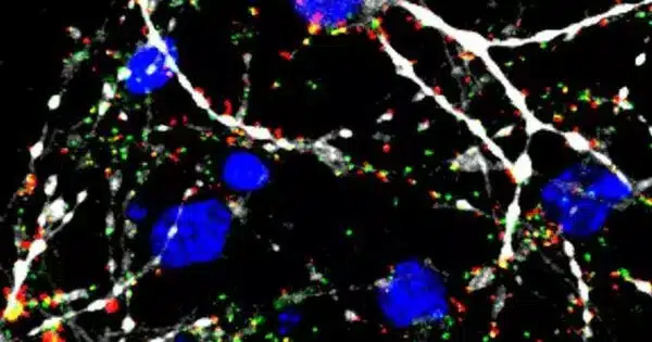 A Deadly Brain Cancer’s hidden Weakness is discovered by Scientists