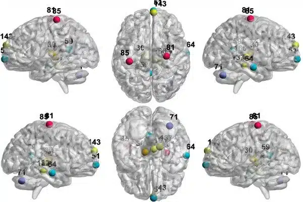 Study finds brain connectivity, memory improves in older adults after walking